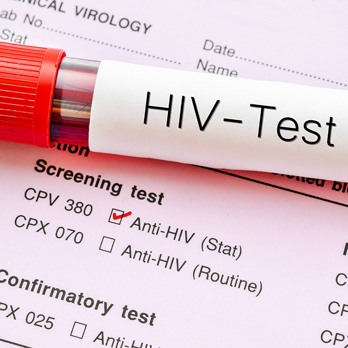 HIV-Test with blood sample and virology form
